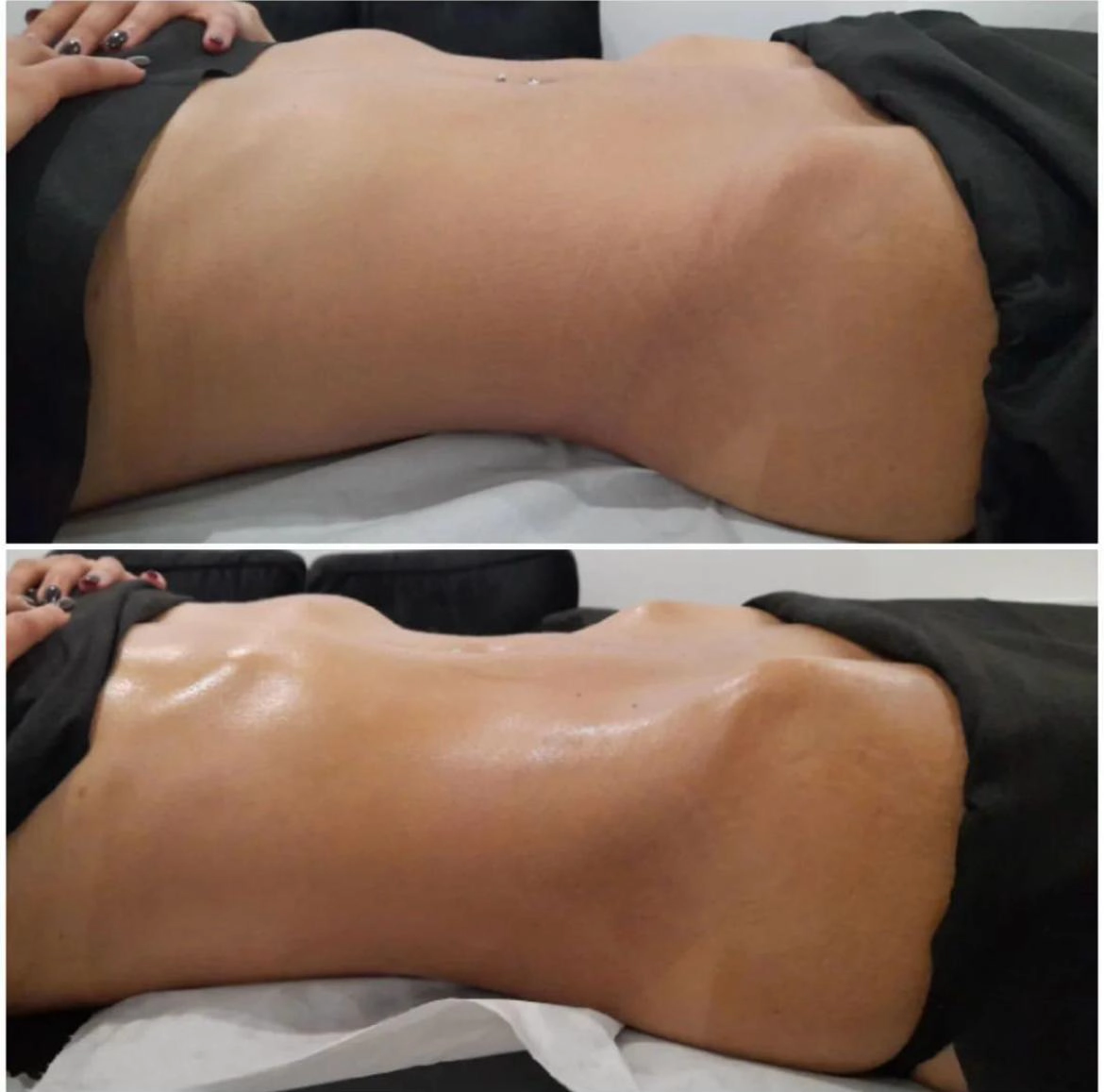 images results before after 1