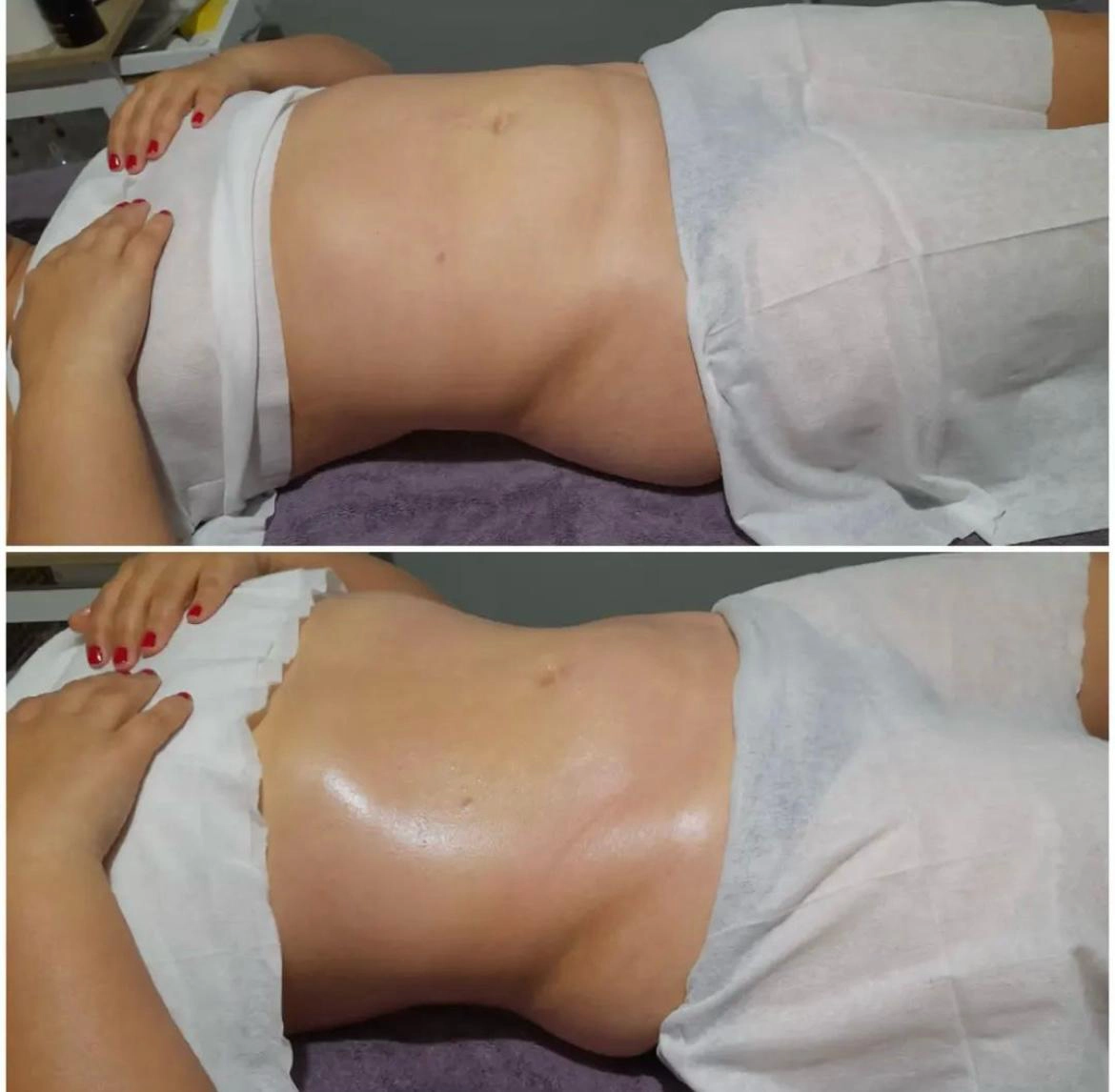 images results before after 2