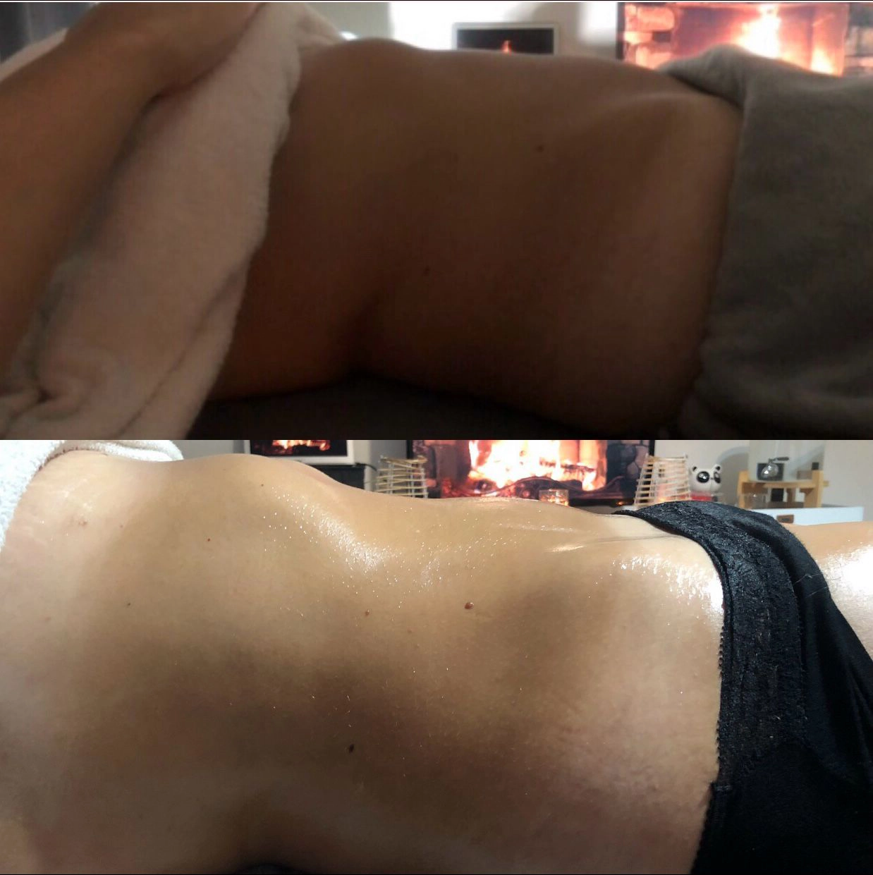 images results before after 3